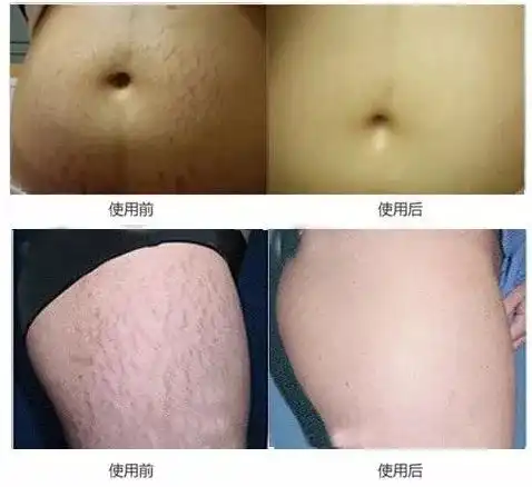 肚子一抓一坨肉一招平坦小腹半个月瘦到掉裤子这个夏天你也可以很骨感