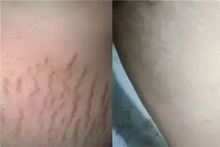 热巴身材再次掉下神坛,肚子上密密麻麻的肥胖纹太惊悚了
