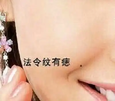 散财痣点了还会破财吗