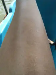 皮肤起小白点图片