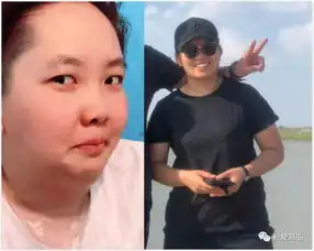 曾经胖成表情包的她,28天甩掉11斤,西瓜脸变瓜子脸