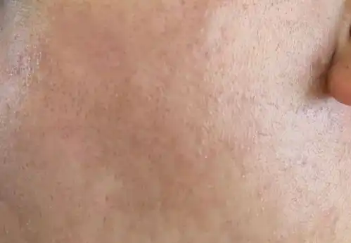 男生反复回购的高质量精华盘点,控油祛痘,美白淡印,修复维稳认准这几款精华就对了,建议收藏码住知乎
