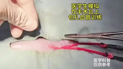 血管包扎是时候展现真正的技术了模拟手术手术室日常血管医学科普
