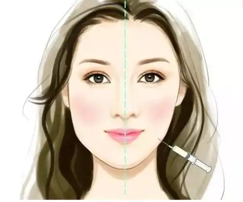 巢湖的美女们注意了瘦脸针千万别随便打,否则就让人......