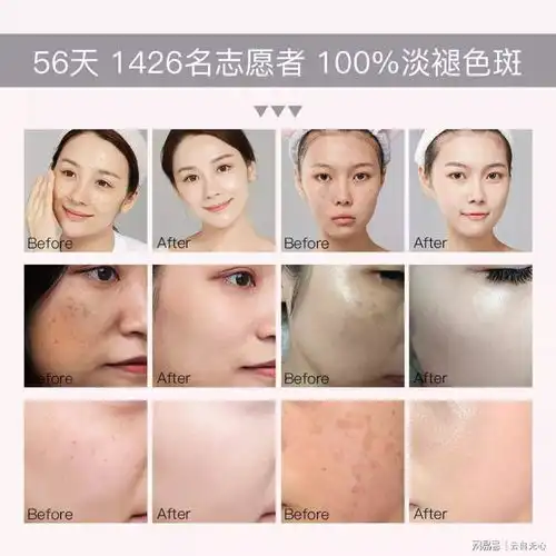 囤货参考淡斑效果好的护肤品