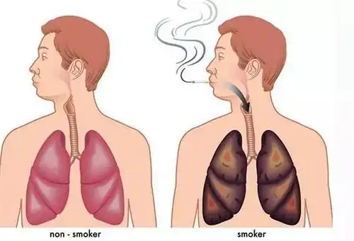 千万不要有戒烟要慢慢来的想法,戒烟要这样戒