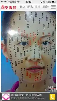 这种痣有什么影响鼻子旁边,好像是破财那个位置