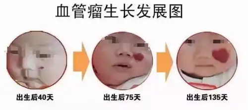 当孩子身上出现以下三种情况就要注意了